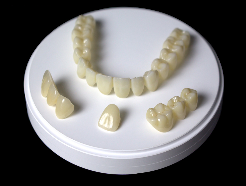Zirconia Crowns Specialist Dentist Dental Clinic In Delhi India