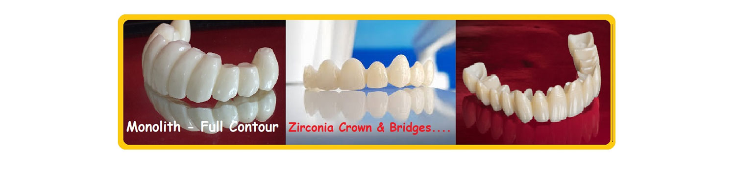 Zirconia Crown Delhi
