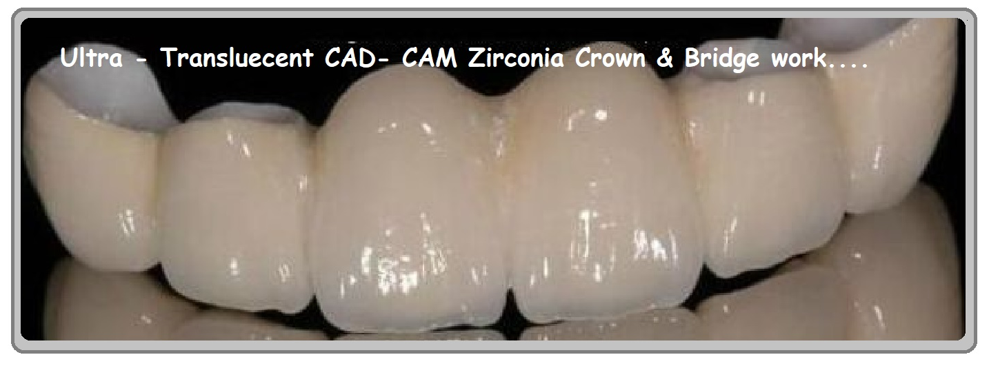 Specialised Translucent Full Contour Monolithic Zirconia Crowns Delhi India