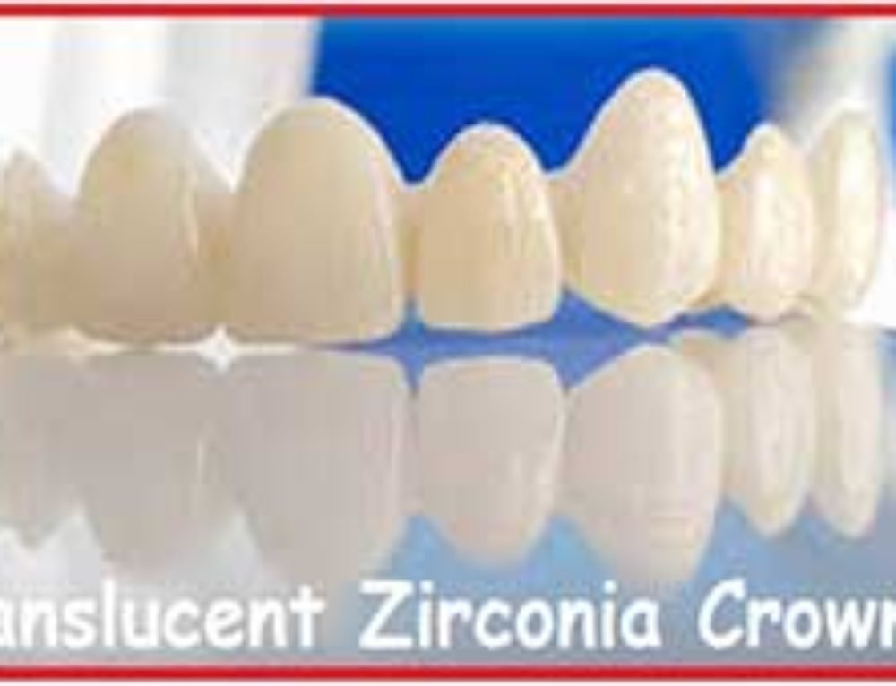 What is a Dental Crown? Zirconia Dental Crown Treatment in Delhi India