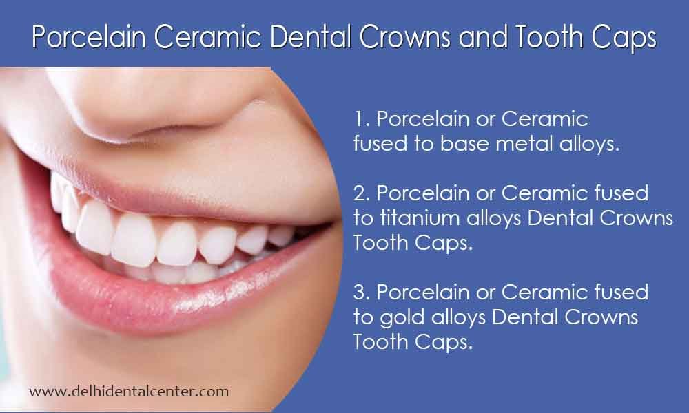 Dental Crowns in East delhi Crown Dentist in Delhi, Dental Clinic Delhi