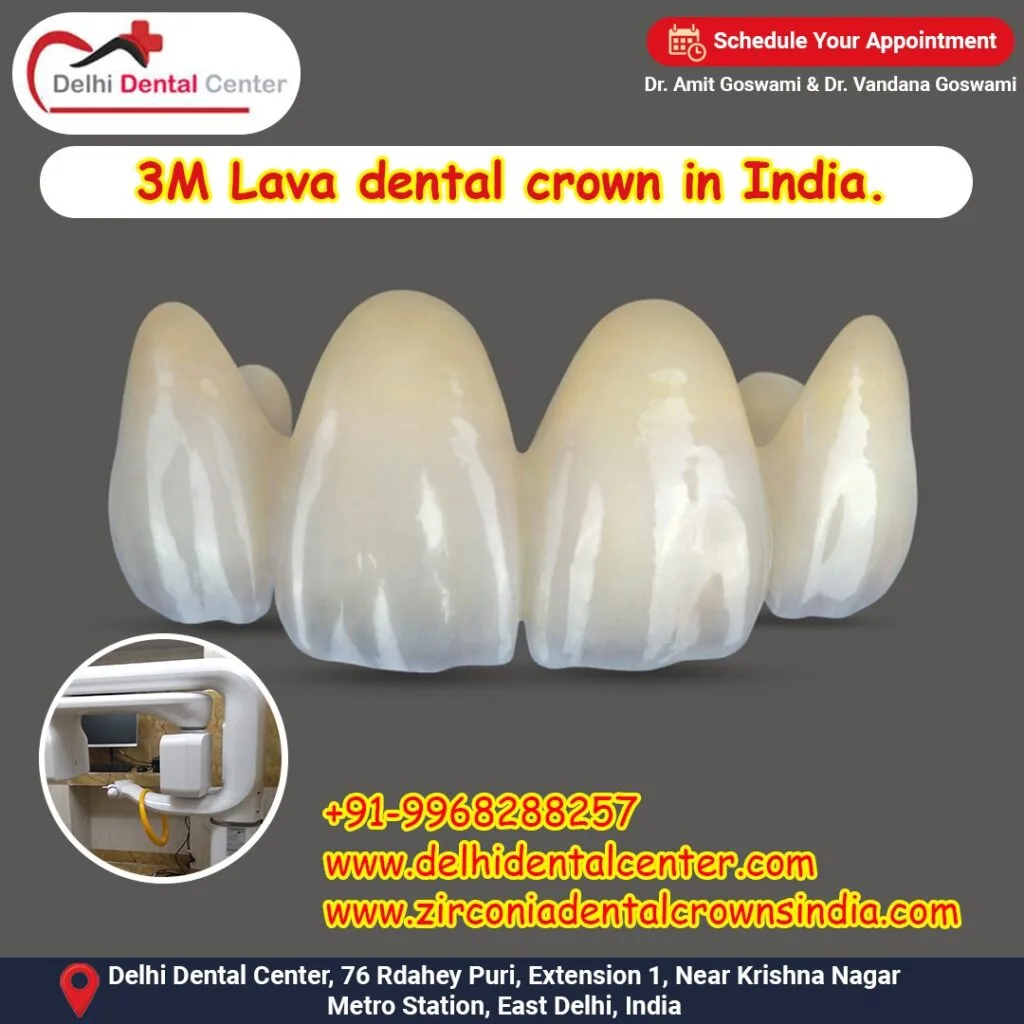 Zirconia CAD CAM Metal free Porcelain Ceramic Dental Crowns, Best top-quality Porcelain dental crowns in India.