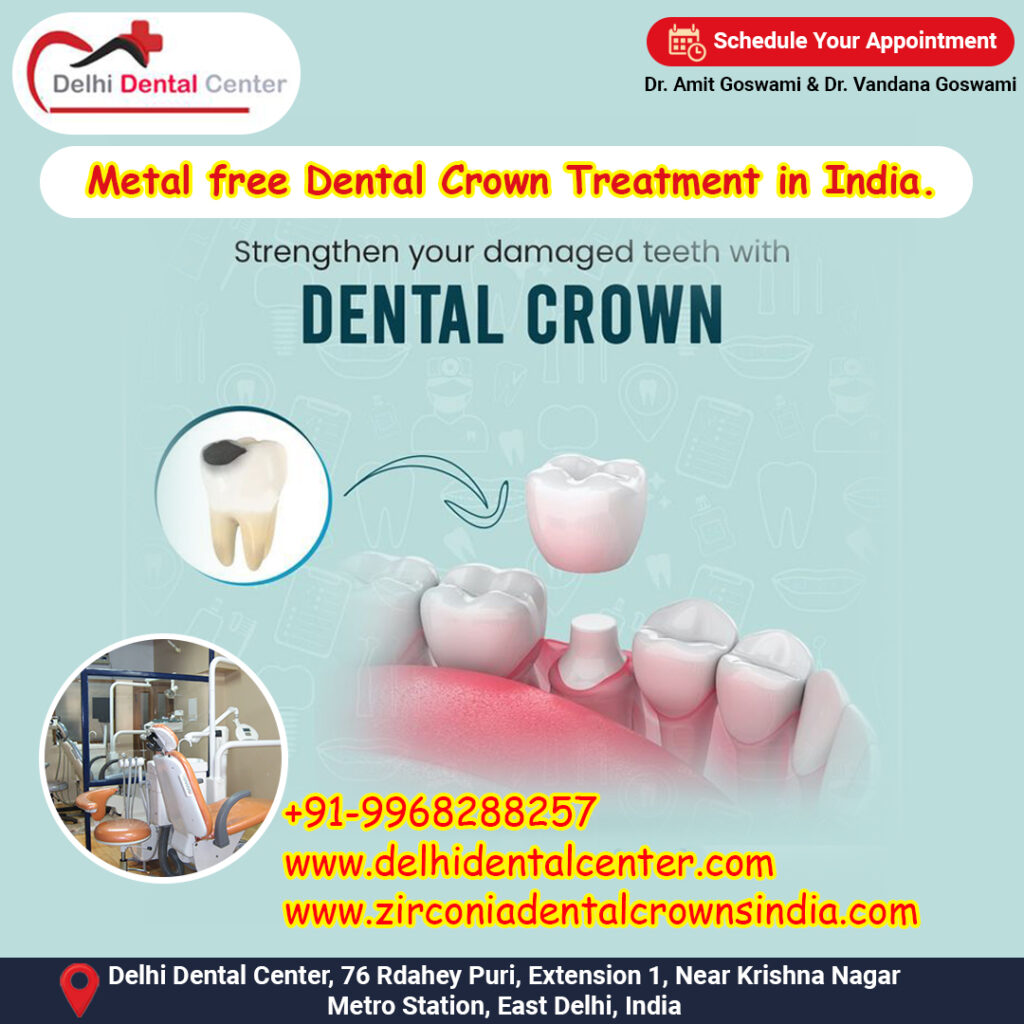 Zirconia CAD CAM Metal free Porcelain Ceramic Dental Crowns, Zirconia Dental Crown in India.