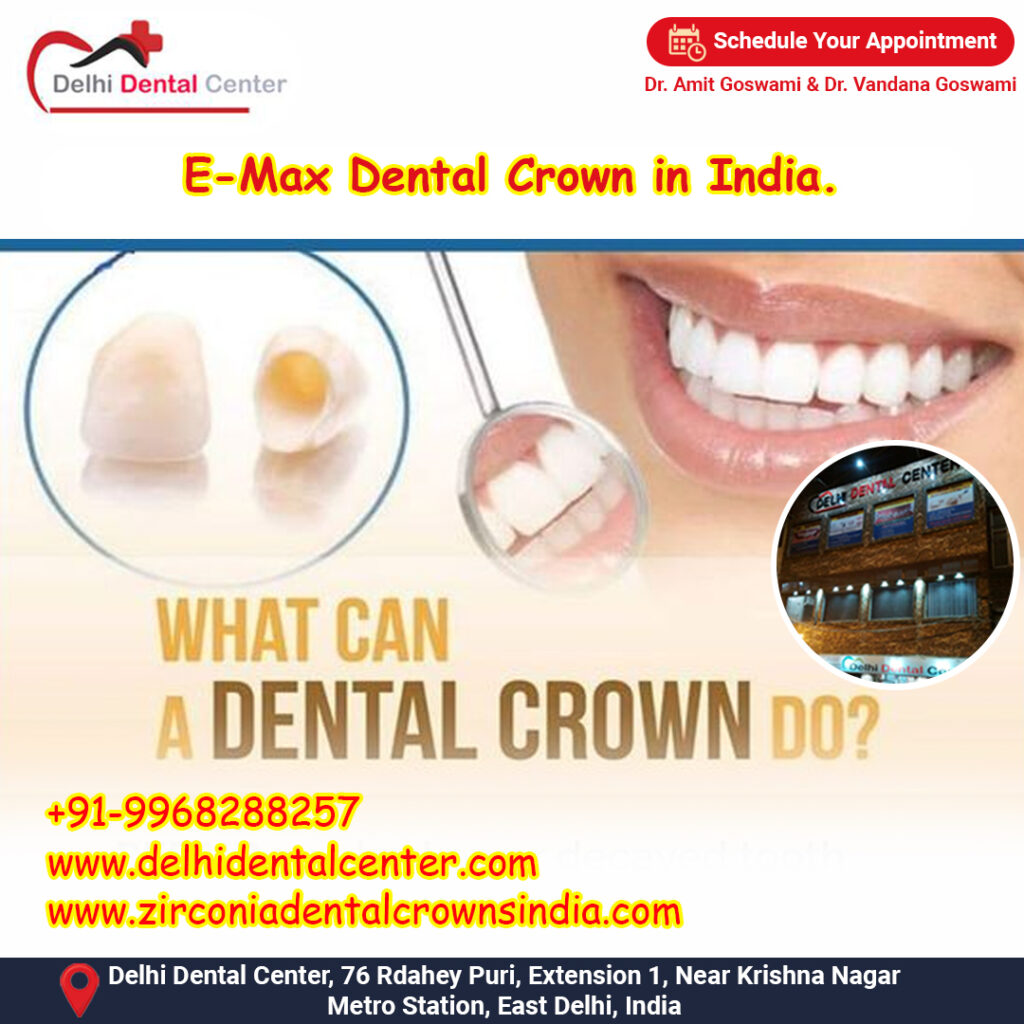 Zirconia CAD CAM Metal free Porcelain Ceramic Dental Crowns, Long lasting lifespan of zirconia dental crown in India.
