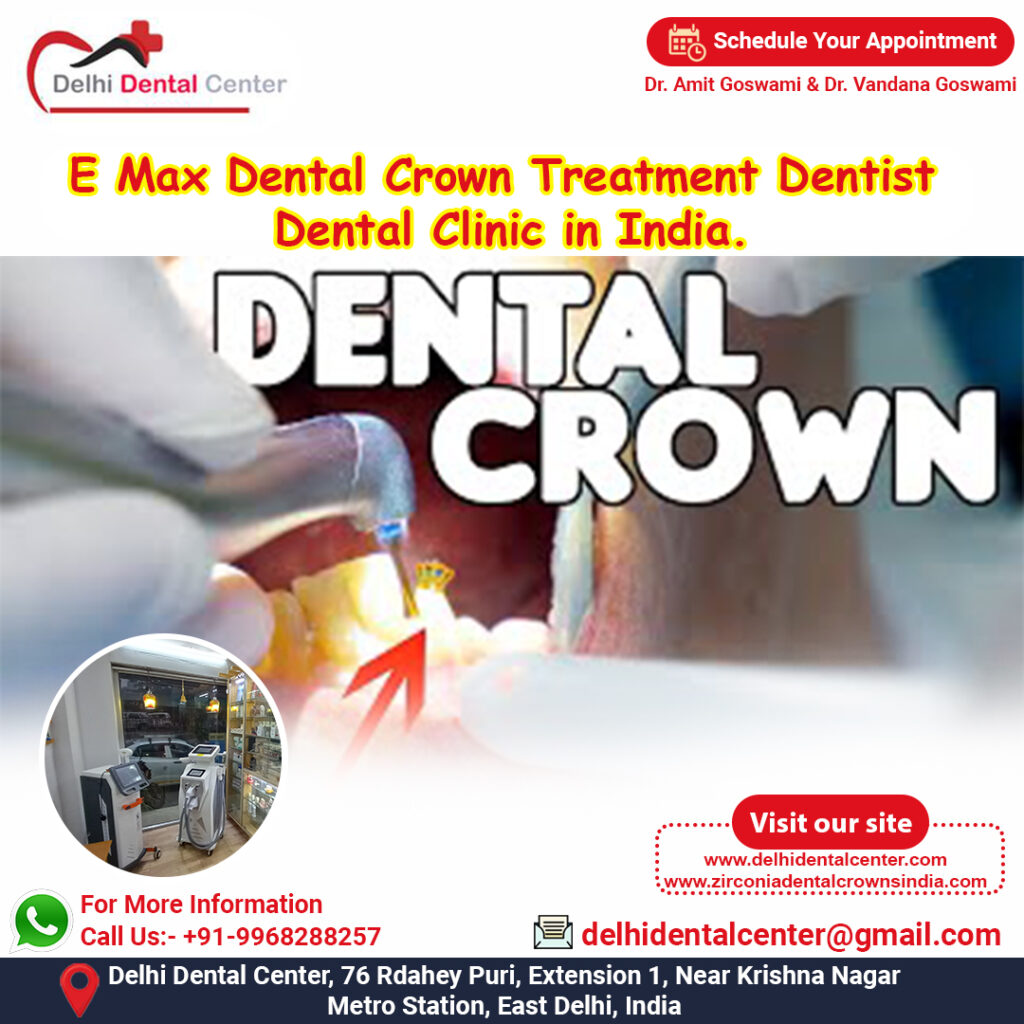 Zirconia CAD CAM Metal free Porcelain Ceramic Dental Crowns, Long life span long lasting do zirconium dental crowns in India.