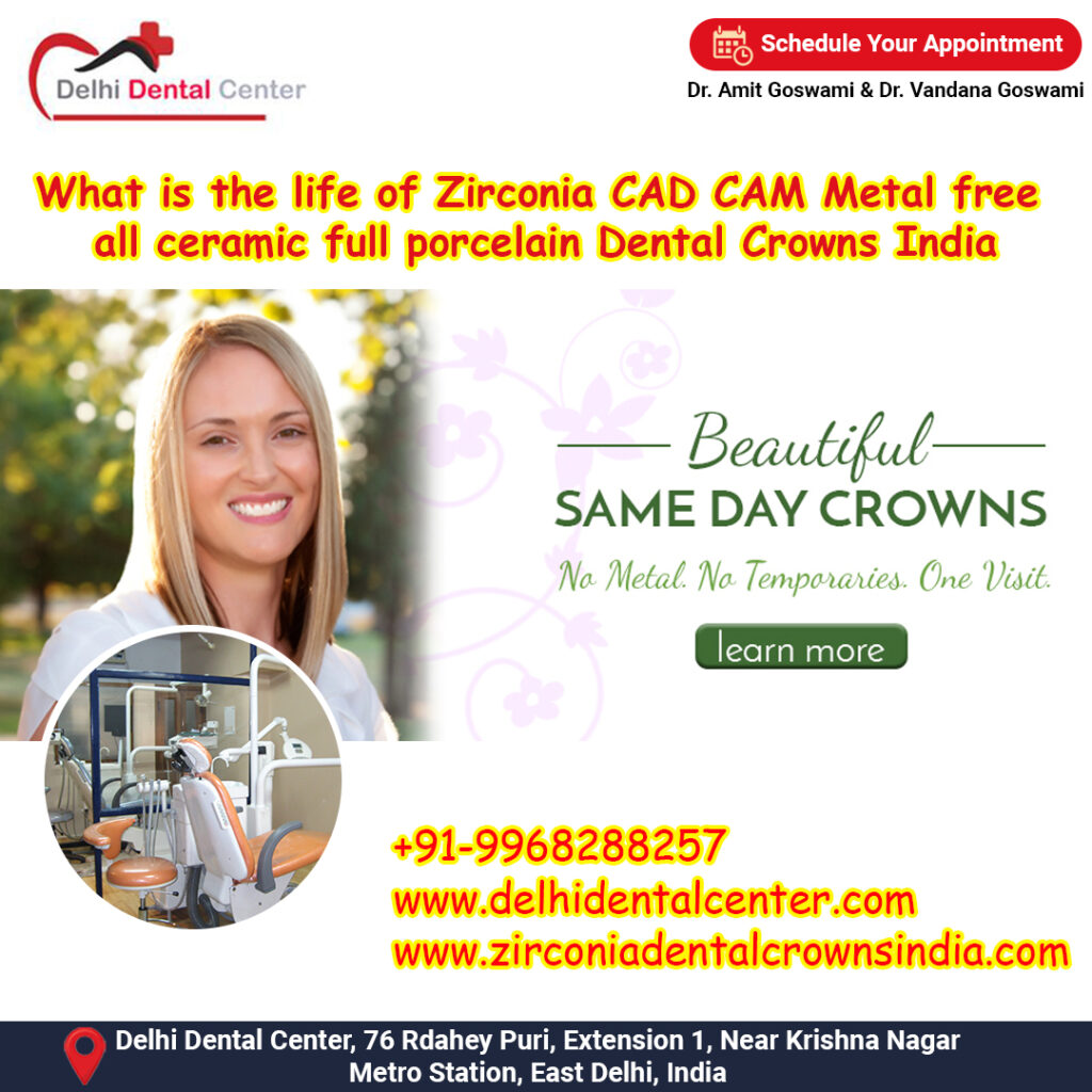 What is the life of Zirconia CAD CAM Metal free all ceramic full porcelain Dental Crowns in India.