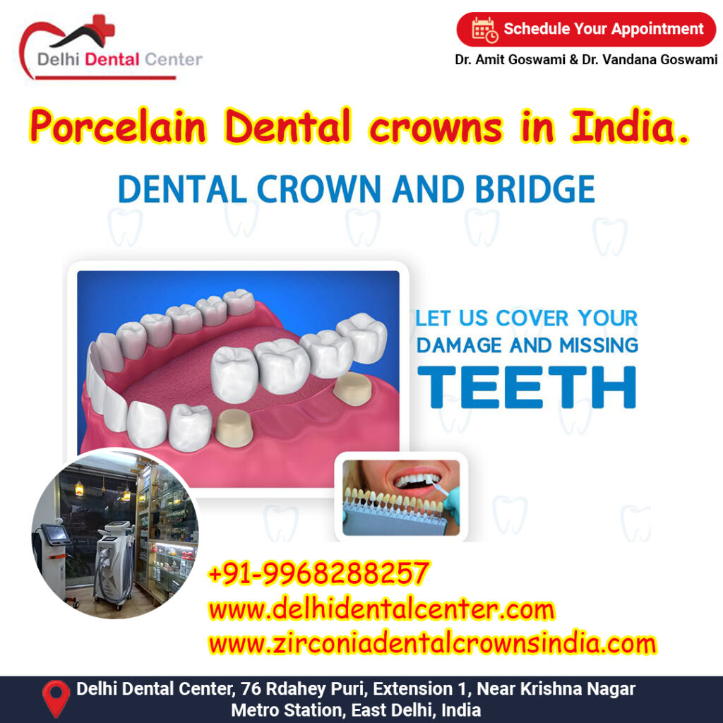 Porcelain dental crown in India.