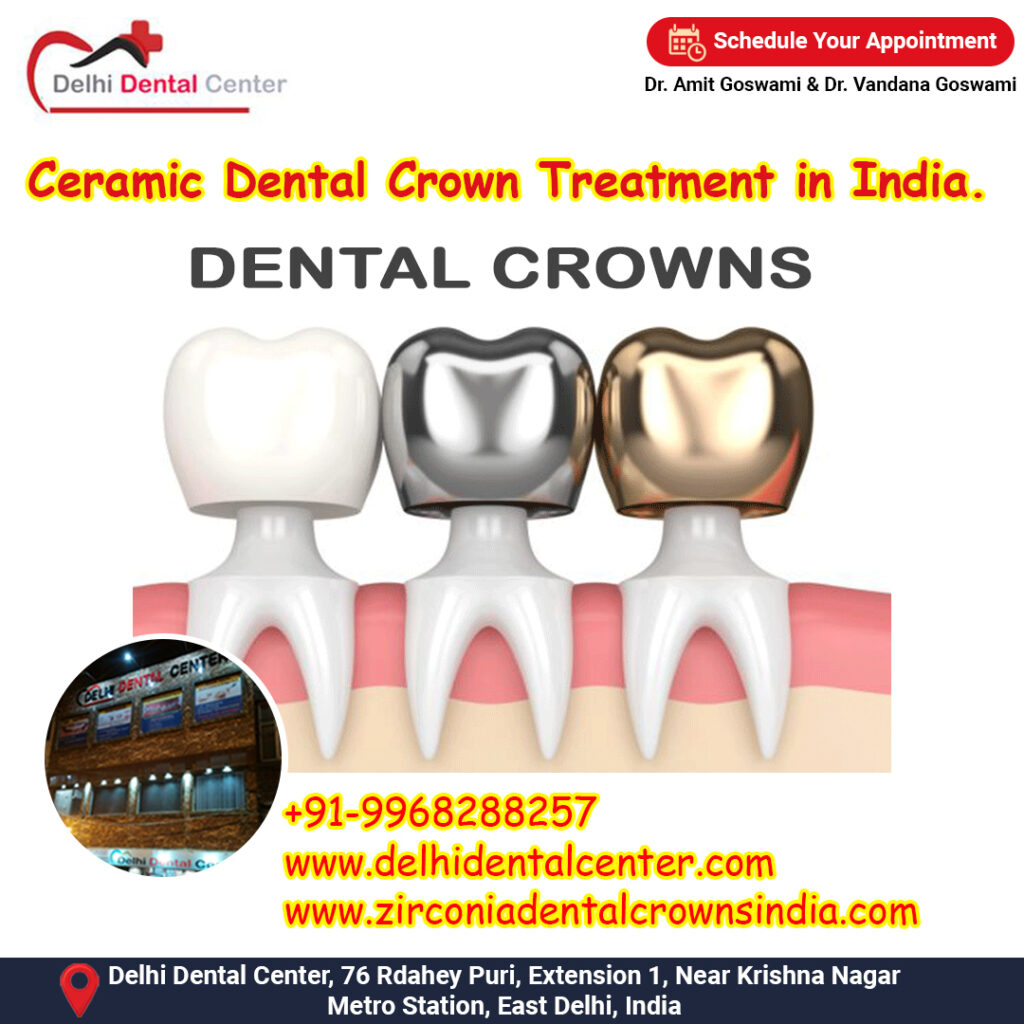 Ceramic Dental Crown Treatment in India.
