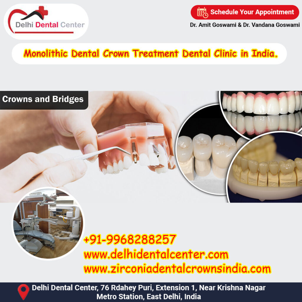 Monolithic Dental Crown Treatment Dental Clinic in India.