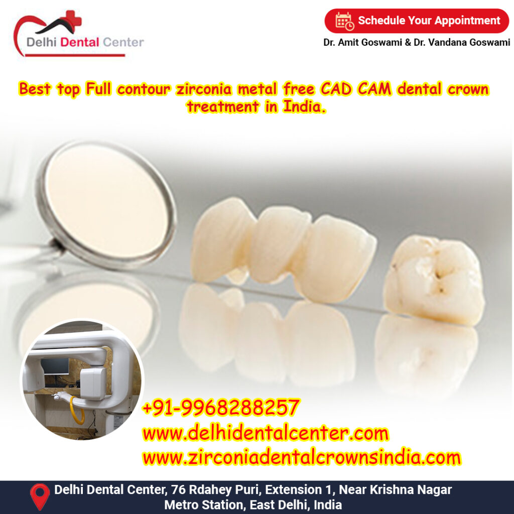 Best top Full contour zirconia metal free CAD CAM dental crown treatment in India.