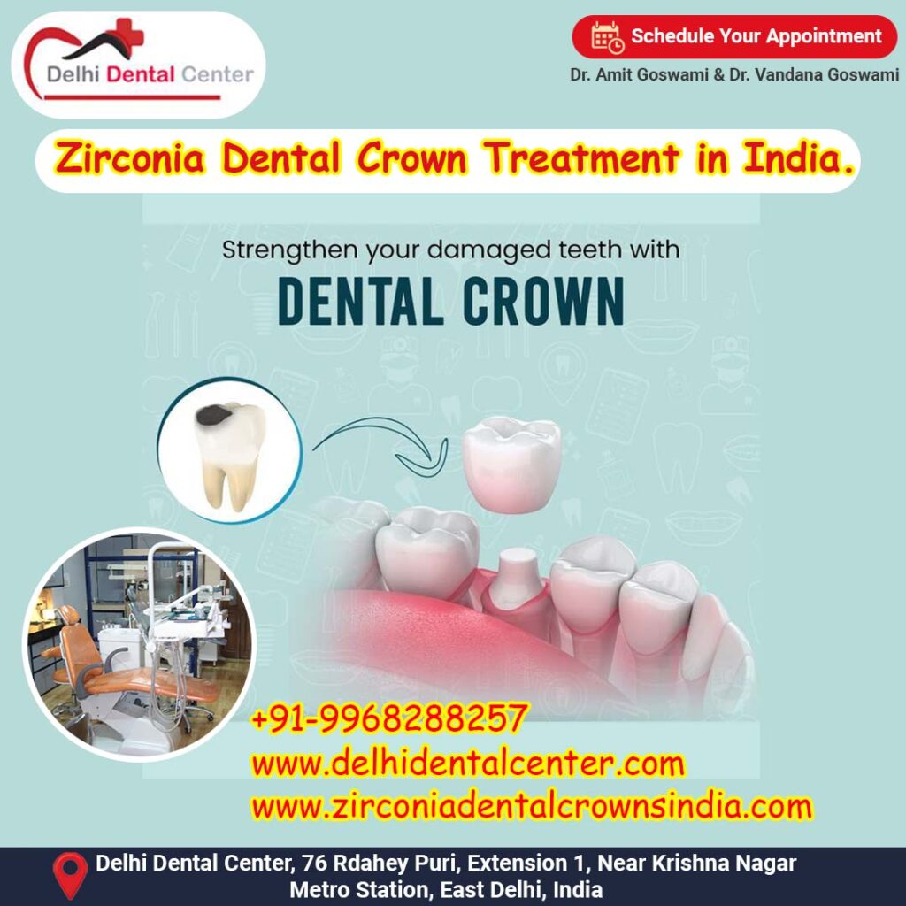 Zirconia Dental Crown Treatment in India.
